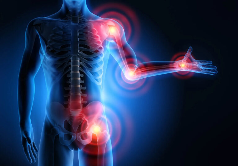 BioPep’s Publication Outlines Promising New Treatment Options for Restoring Damaged Cartilage in Osteoarthritis, which Affects Millions Worldwide